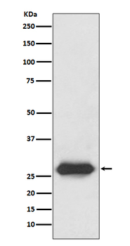 Lin28 Rabbit mAb Antibody