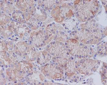 CD147 Rabbit mAb [KD Validated] Antibody