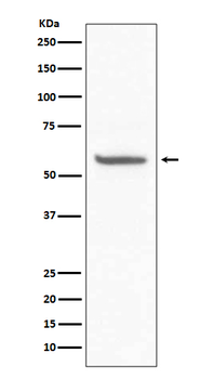 CD147 Rabbit mAb [KD Validated] Antibody