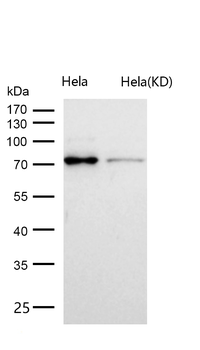ABCG2 Rabbit mAb [KD Validated] Antibody