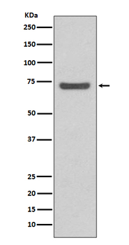 ABCG2 Rabbit mAb [KD Validated] Antibody