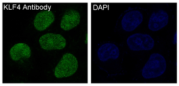KLF4 Rabbit mAb Antibody