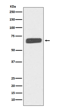 Collagen X Rabbit mAb Antibody