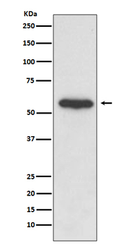 Src Rabbit mAb [KD Validated] Antibody