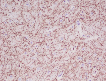 Myelin Basic Protein Rabbit mAb Antibody