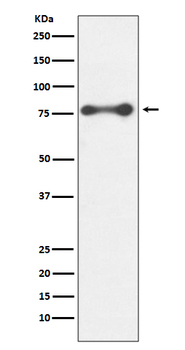PKC delta Rabbit mAb [KD Validated] Antibody