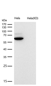 E2F1 Rabbit mAb [KD Validated] Antibody