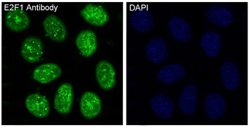 E2F1 Rabbit mAb [KD Validated] Antibody