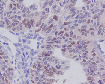 E2F1 Rabbit mAb [KD Validated] Antibody