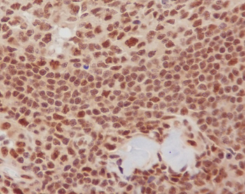 K63-linkage Specific Ubiquitin Rabbit mAb Antibody