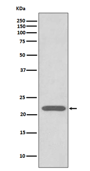 Peroxiredoxin 2 Rabbit mAb Antibody