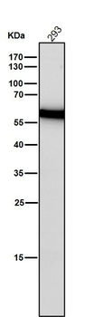 Estrogen Receptor beta Rabbit mAb Antibody