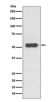 Estrogen Receptor beta Rabbit mAb Antibody