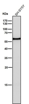Estrogen Receptor beta Rabbit mAb Antibody
