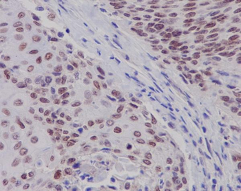Estrogen Receptor beta Rabbit mAb Antibody