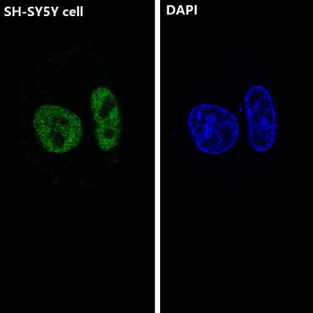 ARID1A Rabbit mAb [KD Validated] Antibody