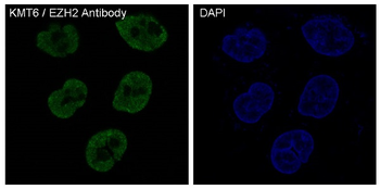 KMT6 / EZH2 Rabbit mAb Antibody