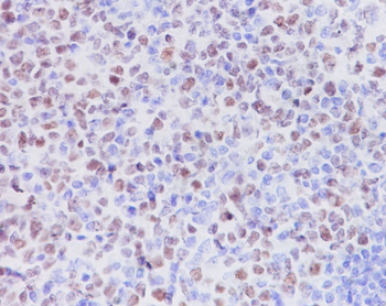 KMT6 / EZH2 Rabbit mAb Antibody