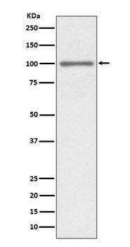KMT6 / EZH2 Rabbit mAb Antibody