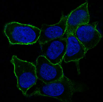 Integrin alpha 5 Rabbit mAb [KD Validated] Antibody