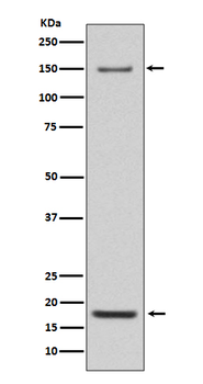 Integrin alpha 5 Rabbit mAb [KD Validated] Antibody