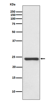 HSPB8/HSP22 Rabbit mAb [KD Validated] Antibody