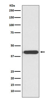 HDAC8 Rabbit mAb Antibody