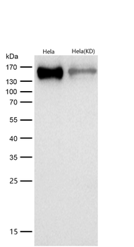 HDAC4 Rabbit mAb [KD Validated] Antibody