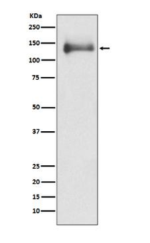 HDAC4 Rabbit mAb [KD Validated] Antibody