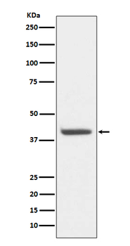 HDAC8 Rabbit mAb Antibody