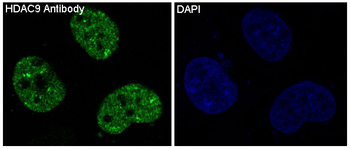 HDAC9 Rabbit mAb [KD Validated] Antibody