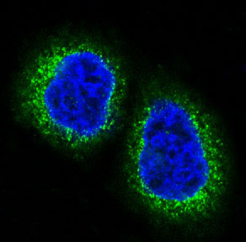 HDAC10 Rabbit mAb Antibody