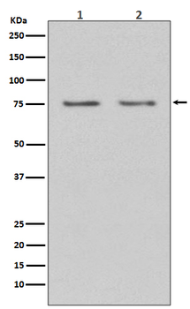 HDAC10 Rabbit mAb Antibody