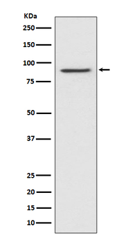 STAT1 alpha Rabbit mAb Antibody