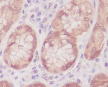 Caspase-6 Rabbit Monoclonal Antibody