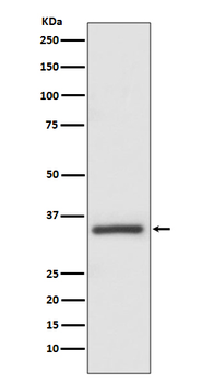 Caspase-6 Rabbit Monoclonal Antibody