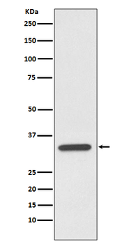 pro Caspase 7 Rabbit mAb Antibody