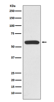 IRF6 Rabbit mAb Antibody