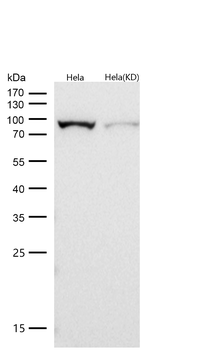 Insulin Receptor Rabbit mAb [KD Validated] Antibody