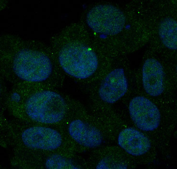 Insulin Receptor Rabbit mAb [KD Validated] Antibody