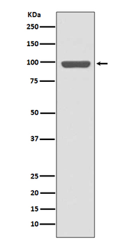 Insulin Receptor Rabbit mAb [KD Validated] Antibody
