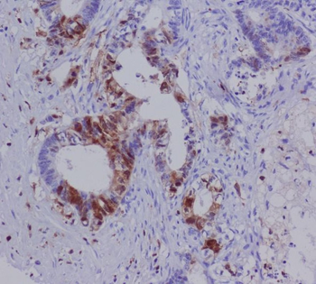 S100A4 Rabbit Monoclonal Antibody