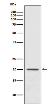 ARF1 Rabbit mAb [KD Validated] Antibody