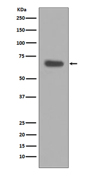 pro Caspase 10 Rabbit mAb Antibody