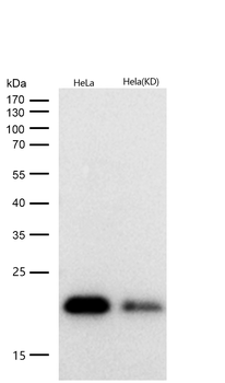 PARK7 Rabbit mAb [KD Validated] Antibody