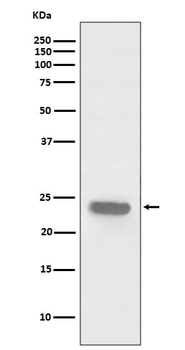 PARK7 Rabbit mAb [KD Validated] Antibody