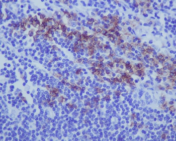 CD38 Rabbit mAb Antibody