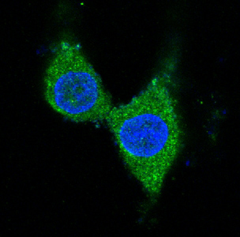 Tyrosine Hydroxylase Rabbit Monoclonal Antibody