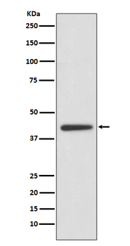 ADIPOR1 Rabbit mAb [KD Validated] Antibody