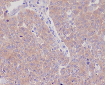 GART Rabbit mAb Antibody